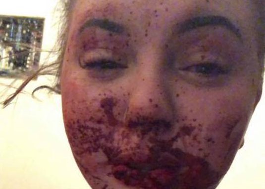 UPDATE: 26 year old in custody after PG woman’s lip bitten off